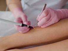 Мастер электроэпиляции