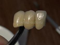 Новая стоматологическая лаборатория в Абхазии 