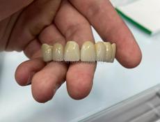 Новая стоматологическая лаборатория в Абхазии 