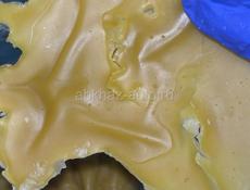 ДИАГНОСТИКА ОТЛИВКА ВОСКОМ