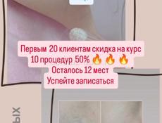 Лазерная эпиляция 