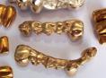 Покупка золотых зубов, коронок и золотых протезов (стоматологическое золото) 