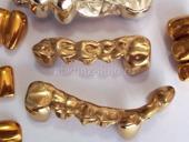 Покупка золотых зубов, коронок и золотых протезов (стоматологическое золото) 