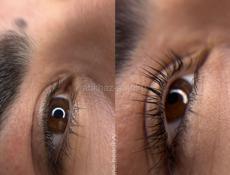 Брови и ресницы