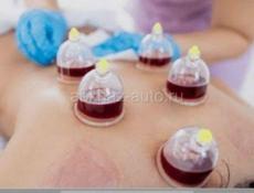 Хиджама терапию 