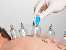 Хиджама терапию 