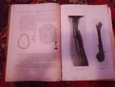 Книга антикварная "Лечение лучами рентгена"
