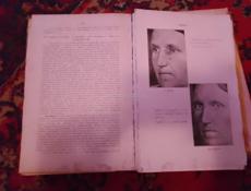 Книга антикварная "Лечение лучами рентгена"