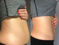 Массажный кабинет