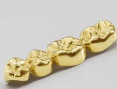 Куплю золотые коронки по самой хорошей цене 