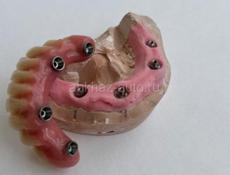 Зубной техник