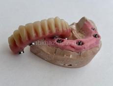 Зубной техник