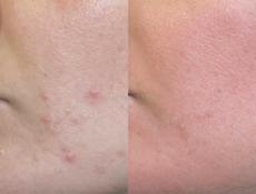 Эффективная болтушка 