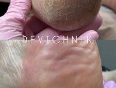 Педикюр 500₽ 