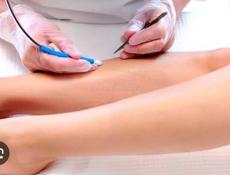 Требуется мастер электроэпиляции 