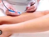 Ищем мастера электроэпиляции