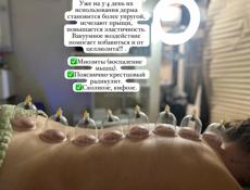 Массаж
