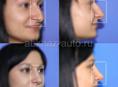23 апреля в г.Сухум в клинике косметологии BeautyMed ведёт приём пластический хирург В.В.Нужный