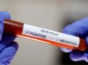 Выявлены еще 53 человека больных коронавирусом