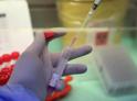 Более 20 случаев коронавируса выявили в Абхазии с 15 июля